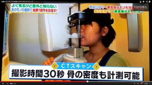 テレビ出演ハルデンタル